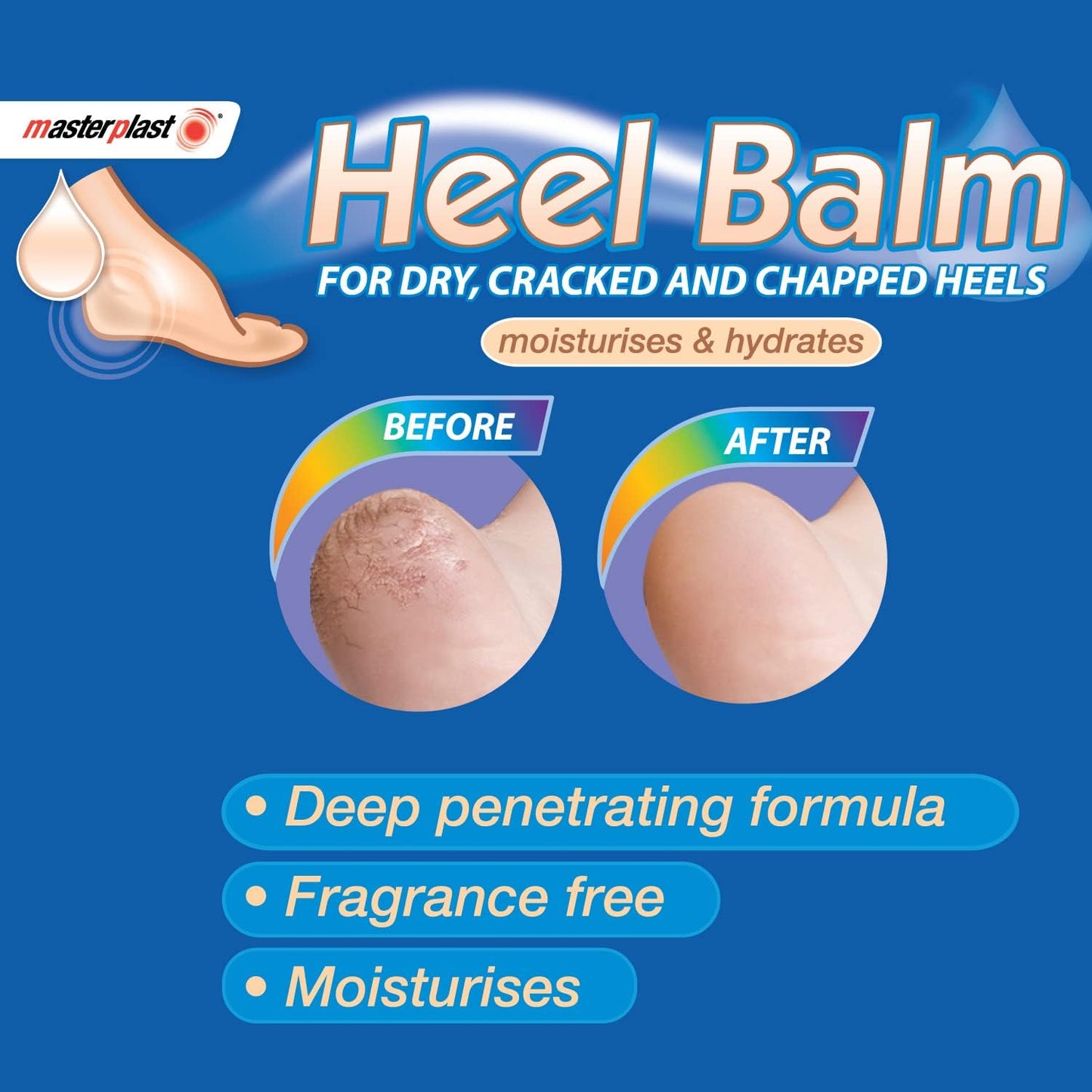 Masterplast Heel Balm (70g For Dry Cracked Heels)